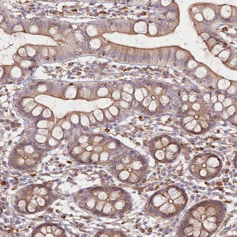 FAM13A Antibody - BSA Free Immunohistochemistry-Paraffin: FAM13A Antibody [NBP1-88825]