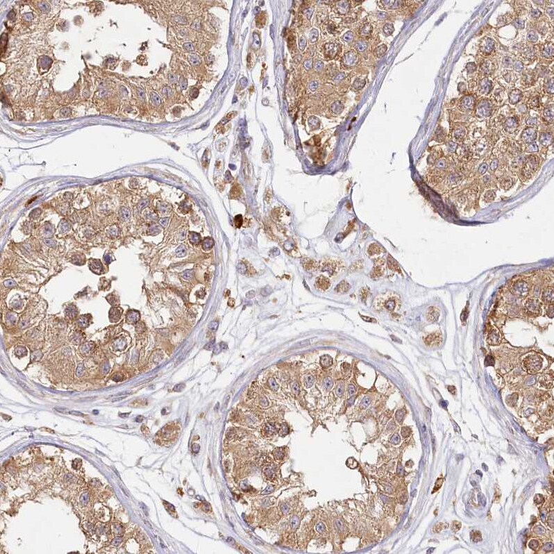 FAM13A Antibody - BSA Free Immunohistochemistry-Paraffin: FAM13A Antibody [NBP1-88825]