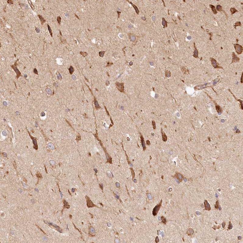 FAM13A Antibody - BSA Free Immunohistochemistry-Paraffin: FAM13A Antibody [NBP1-88825]