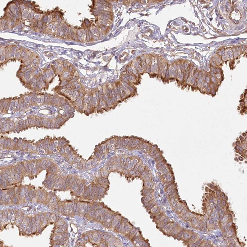 FAM13A Antibody - BSA Free Immunohistochemistry-Paraffin: FAM13A Antibody [NBP1-88825]