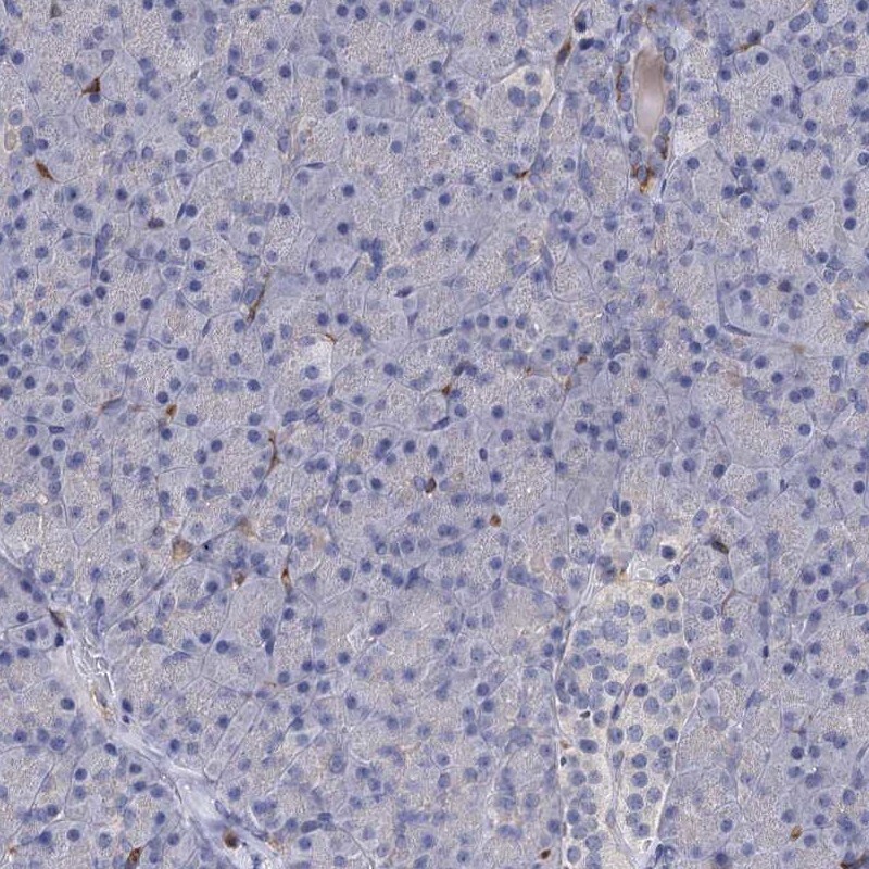 RhoG Antibody - BSA Free Immunohistochemistry-Paraffin: RhoG Antibody [NBP1-88832]