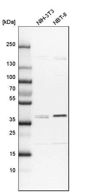 ADPRHL2 Antibody Western Blot: ADPRHL2 Antibody [NBP1-88835] -