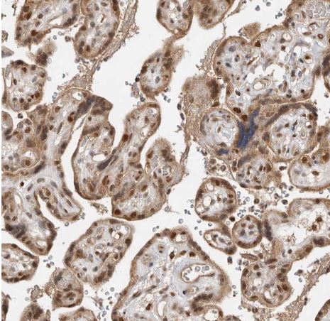 ADPRHL2 Antibody ADPRHL2 Antibody