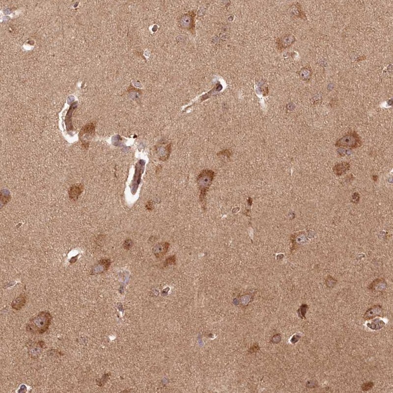 ARL3 Antibody - BSA Free Immunohistochemistry-Paraffin: ARL3 Antibody [NBP1-88839]