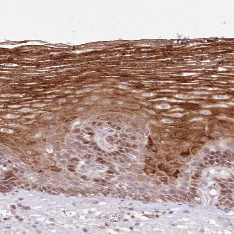 ASCC1 Antibody - BSA Free Immunohistochemistry-Paraffin: ASCC1 Antibody [NBP1-88855]