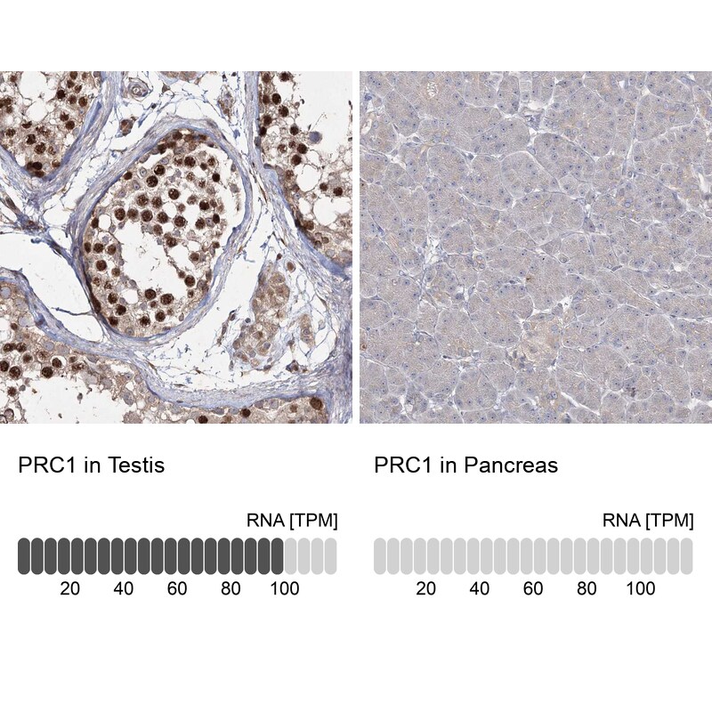 PRC1 Antibody - BSA Free Immunohistochemistry-Paraffin: PRC1 Antibody [NBP1-88856]
