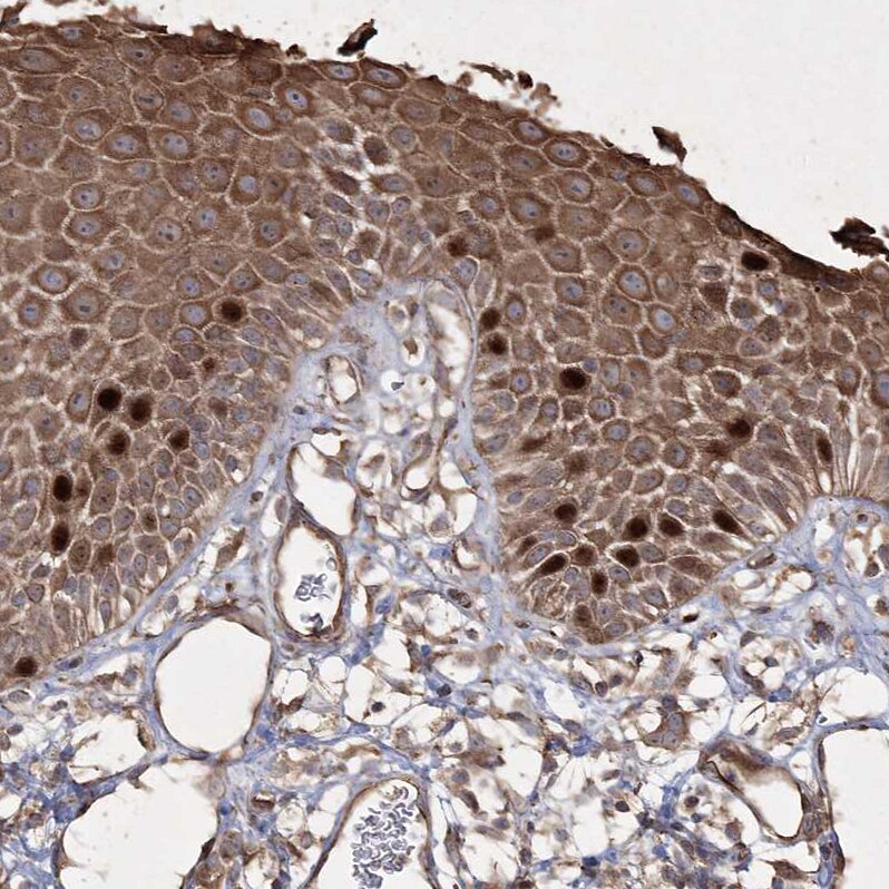 PRC1 Antibody - BSA Free Immunohistochemistry-Paraffin: PRC1 Antibody [NBP1-88856]