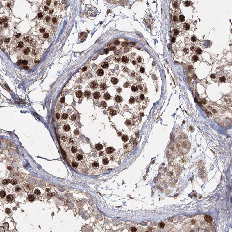 PRC1 Antibody - BSA Free Immunohistochemistry-Paraffin: PRC1 Antibody [NBP1-88856]