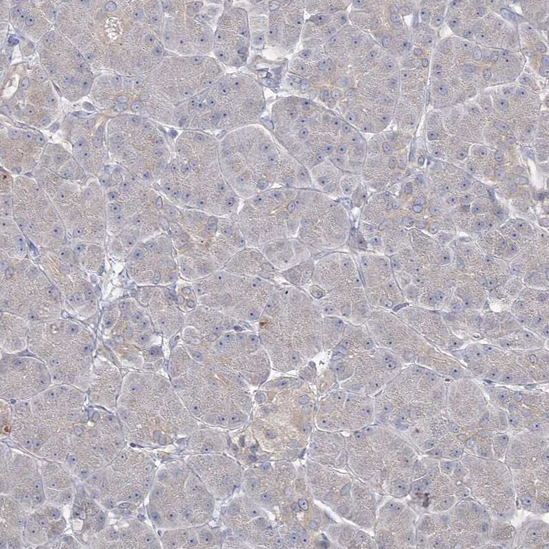 PRC1 Antibody - BSA Free Immunohistochemistry-Paraffin: PRC1 Antibody [NBP1-88856]