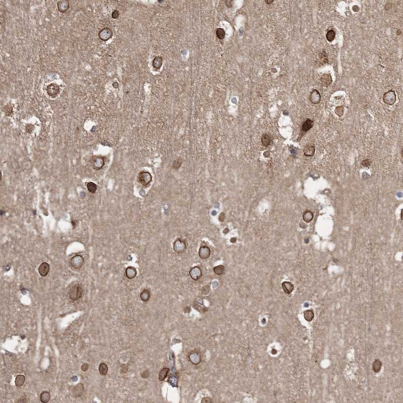 PRC1 Antibody - BSA Free Immunohistochemistry-Paraffin: PRC1 Antibody [NBP1-88856]