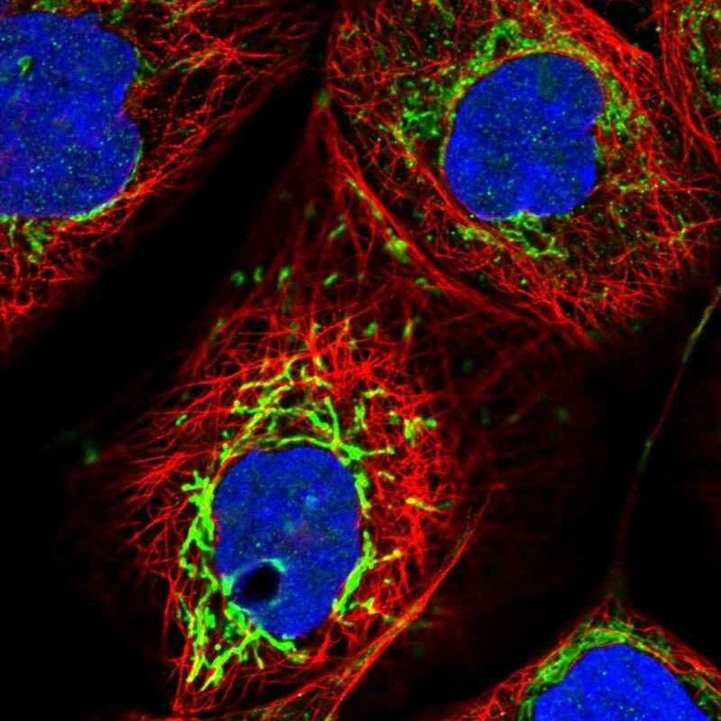 SMPDL3A Antibody - BSA Free Immunocytochemistry/ Immunofluorescence: SMPDL3A Antibody [NBP1-88862]