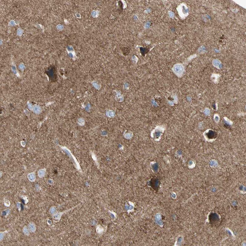 CRTAC1 Antibody - BSA Free Immunohistochemistry: CRTAC1 Antibody [NBP1-88864]