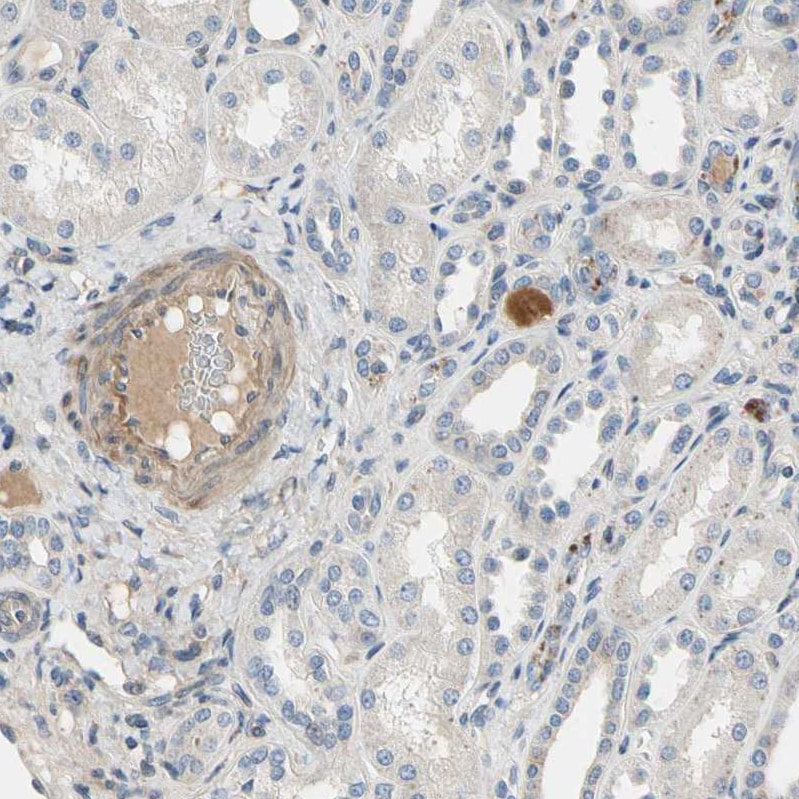 CRTAC1 Antibody - BSA Free Immunohistochemistry: CRTAC1 Antibody [NBP1-88864]