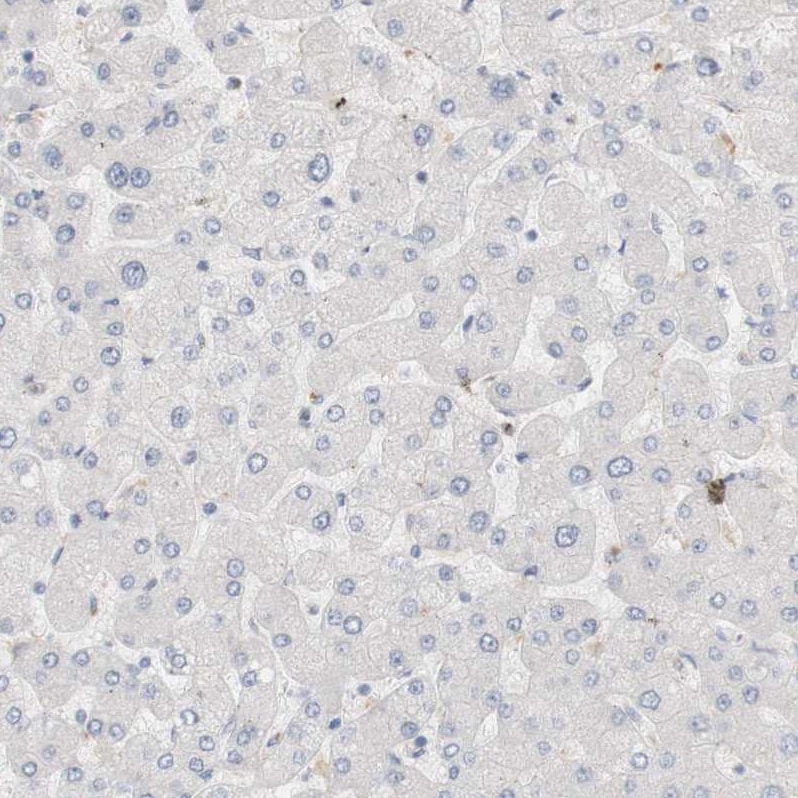 RTN3 Antibody - BSA Free Immunohistochemistry-Paraffin: RTN3 Antibody [NBP1-88871]