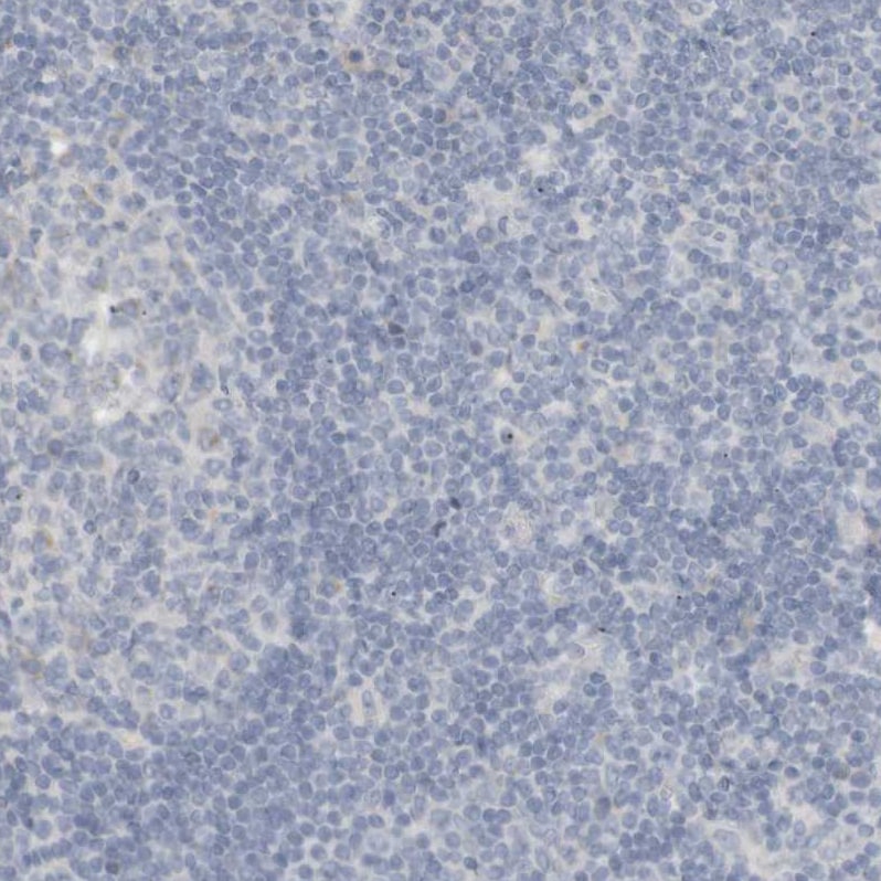 RTN3 Antibody - BSA Free Immunohistochemistry-Paraffin: RTN3 Antibody [NBP1-88871]