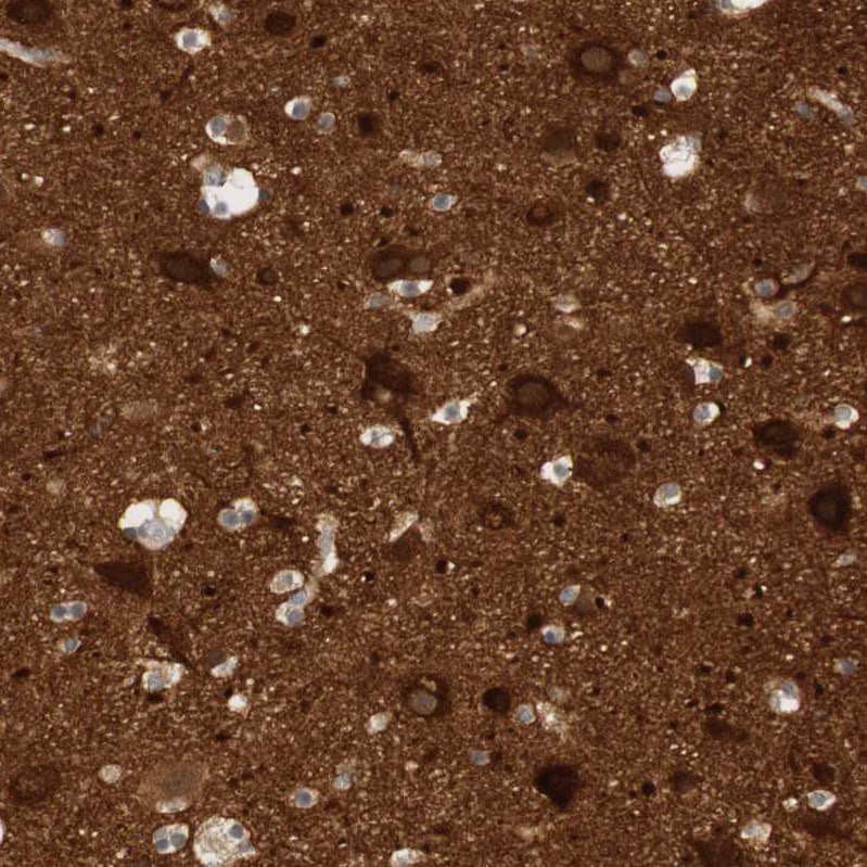 RTN3 Antibody - BSA Free Immunohistochemistry-Paraffin: RTN3 Antibody [NBP1-88871]