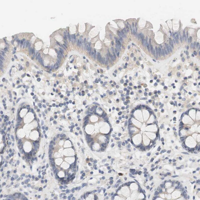 RTN3 Antibody - BSA Free Immunohistochemistry-Paraffin: RTN3 Antibody [NBP1-88871]