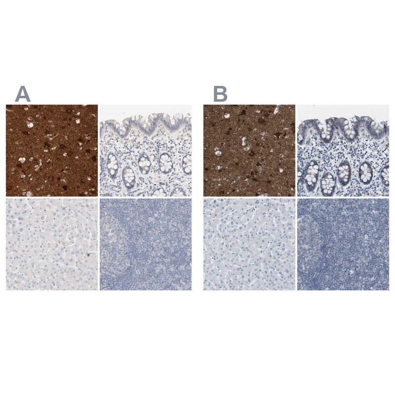 RTN3 Antibody - BSA Free Immunohistochemistry-Paraffin: RTN3 Antibody [NBP1-88871]