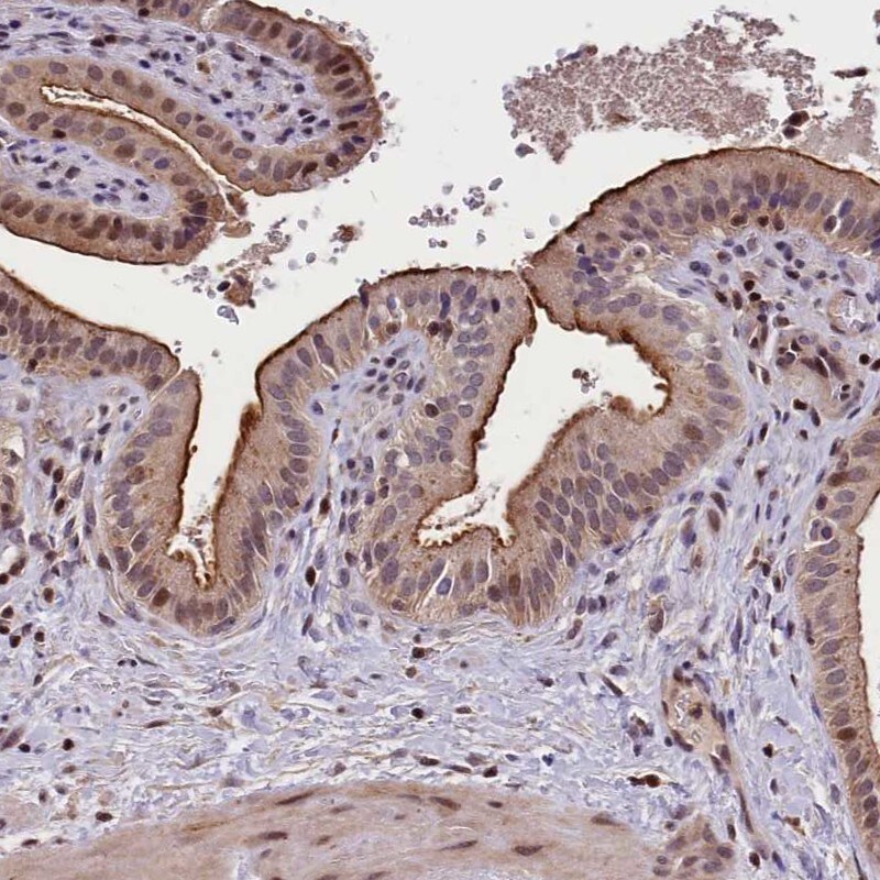 ATG101 Antibody - BSA Free Immunohistochemistry-Paraffin: ATG101 Antibody [NBP1-88877]