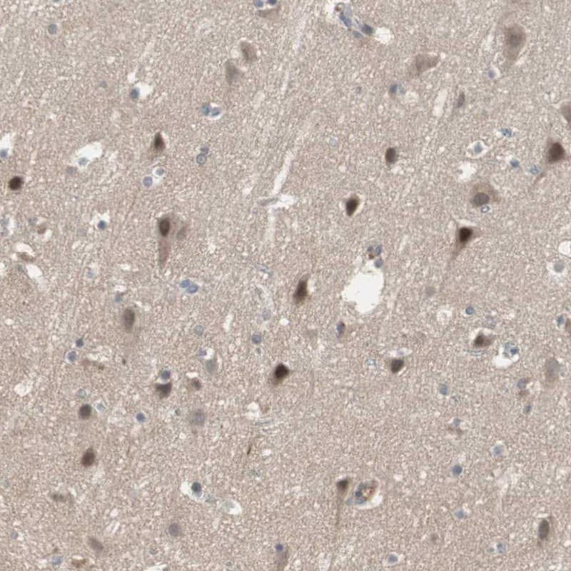 SNX4 Antibody - BSA Free Immunohistochemistry-Paraffin: SNX4 Antibody [NBP1-88882]