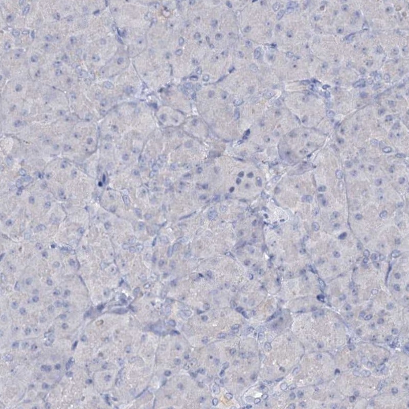 ATP4A Antibody - BSA Free Immunohistochemistry: ATP4A Antibody - BSA Free [NBP1-88889]
