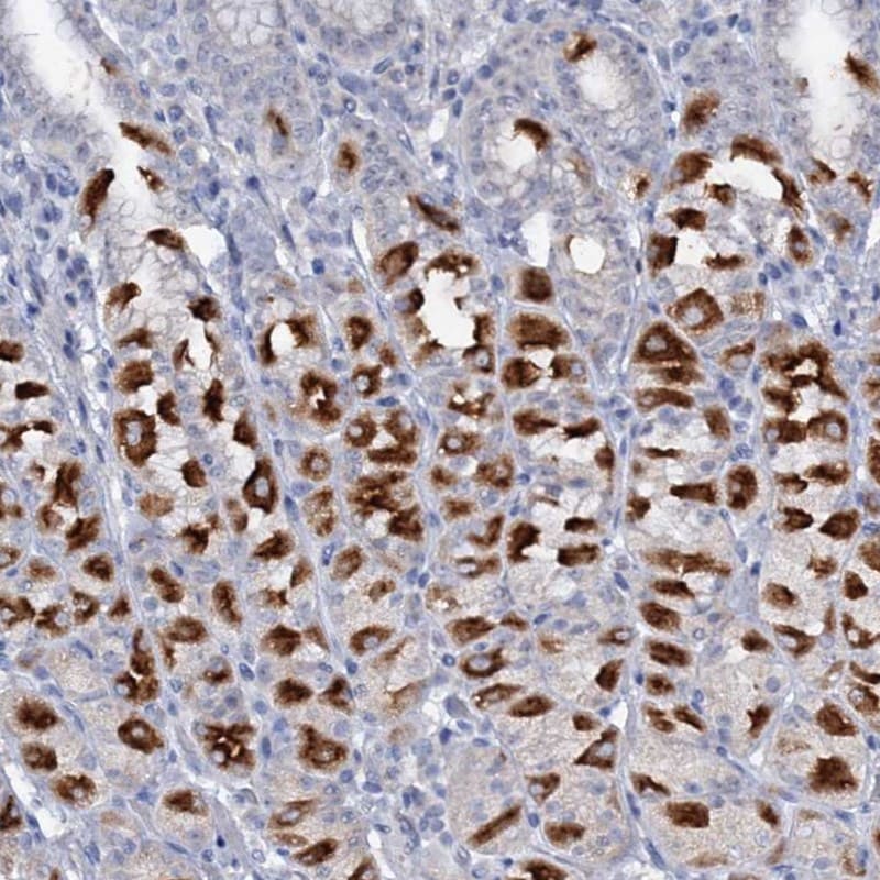 ATP4A Antibody - BSA Free Immunohistochemistry: ATP4A Antibody - BSA Free [NBP1-88889]