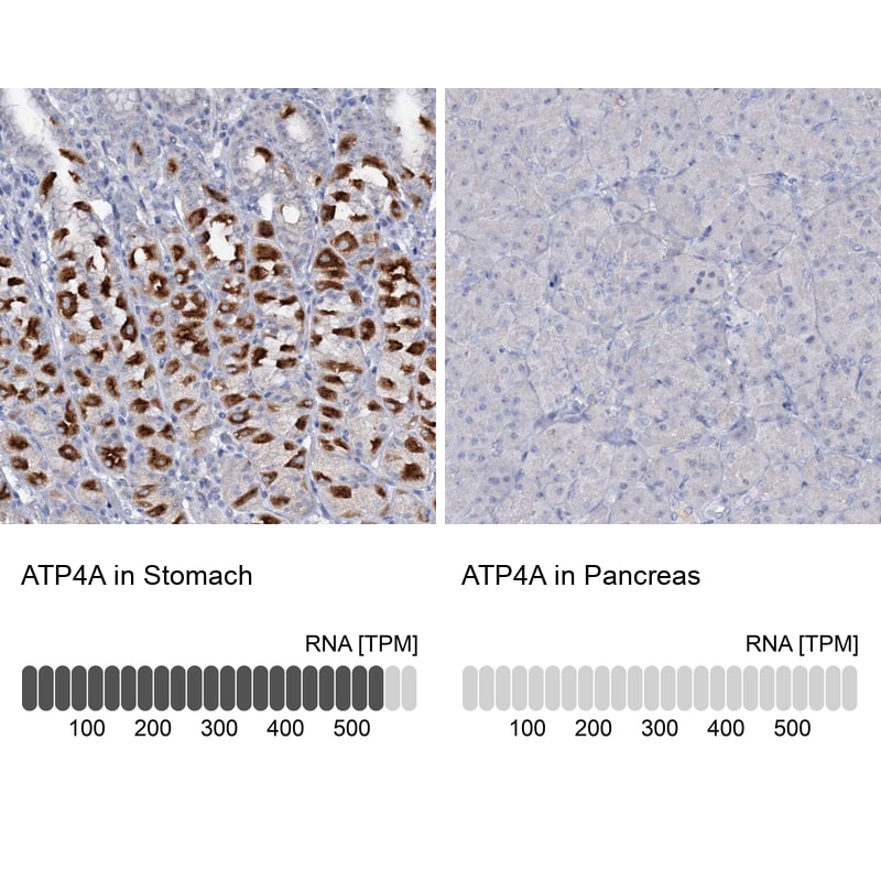 ATP4A Antibody - BSA Free Immunohistochemistry: ATP4A Antibody - BSA Free [NBP1-88889]