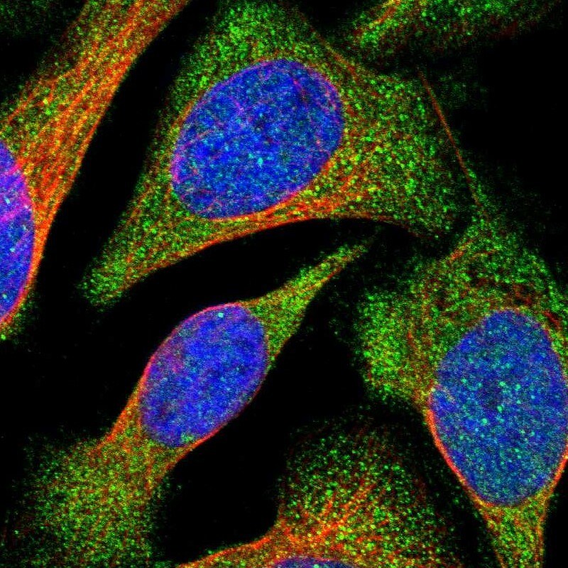 VPS9D1 Antibody - BSA Free Immunocytochemistry/ Immunofluorescence: VPS9D1 Antibody [NBP1-88898]