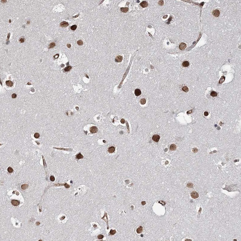 ATP11B Antibody - BSA Free Immunohistochemistry: ATP11B Antibody - BSA Free [NBP1-88901]
