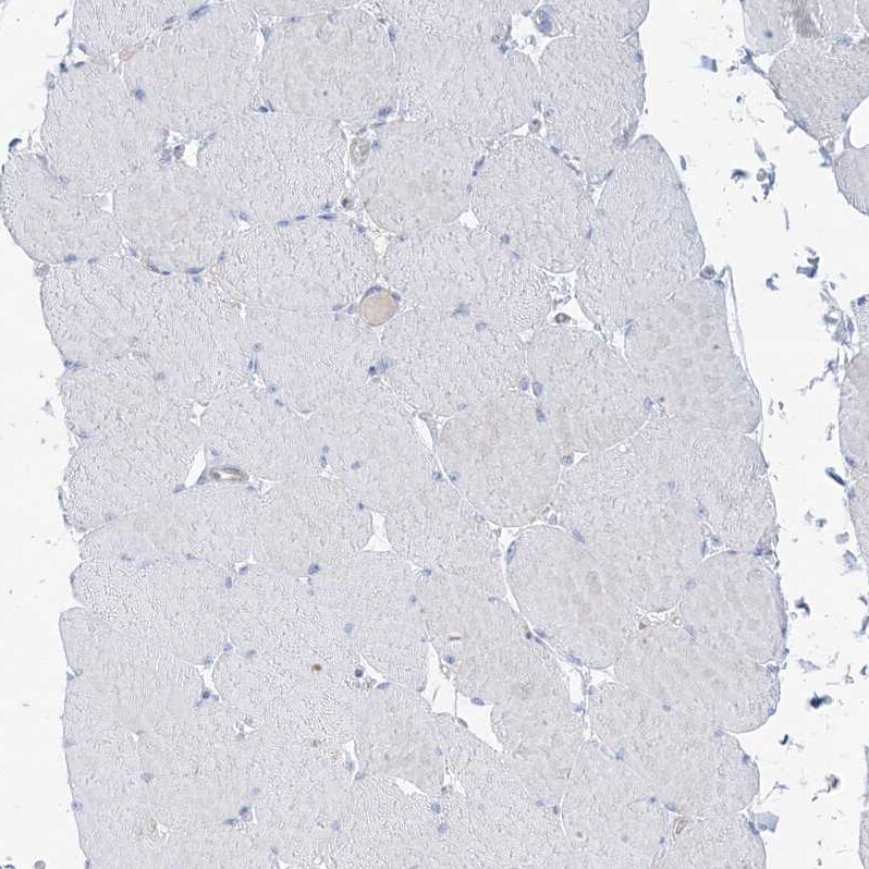 ATP11C Antibody - BSA Free Immunohistochemistry-Paraffin: ATP11C Antibody [NBP1-88902]