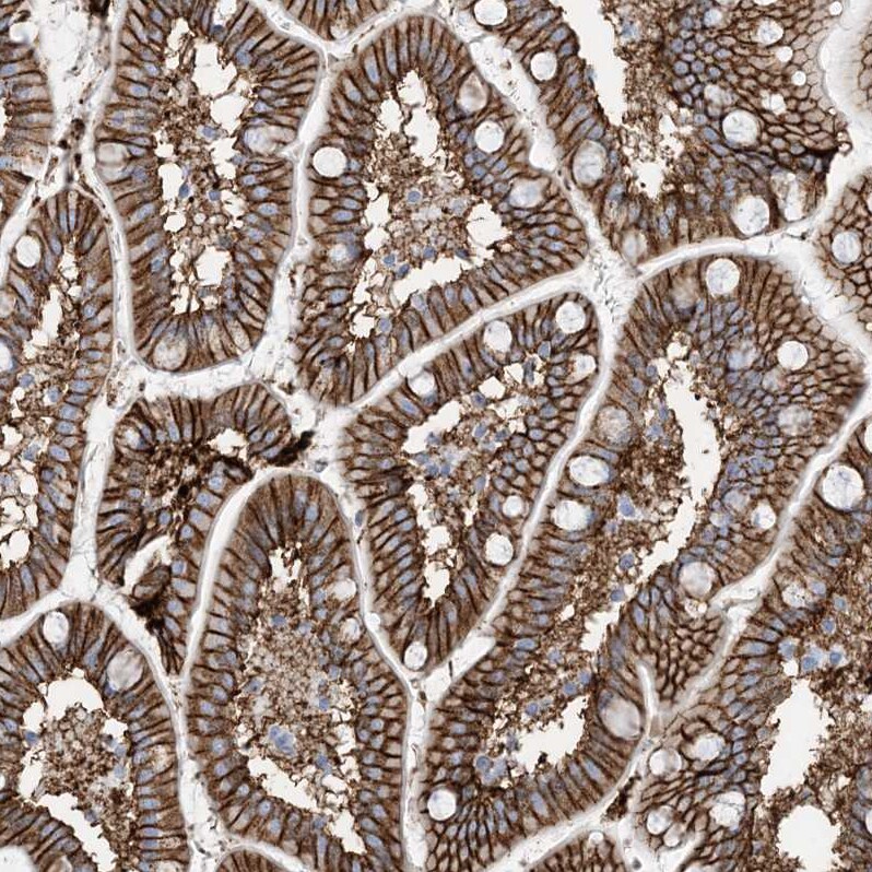 ATP11C Antibody - BSA Free Immunohistochemistry-Paraffin: ATP11C Antibody [NBP1-88902]