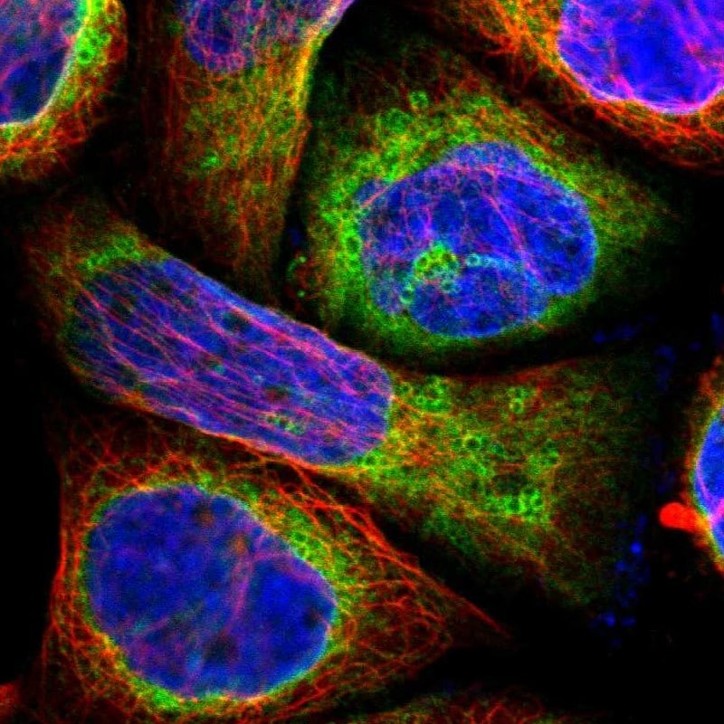 LPCAT2 Antibody - BSA Free Immunocytochemistry/ Immunofluorescence: LPCAT2 Antibody [NBP1-88921]