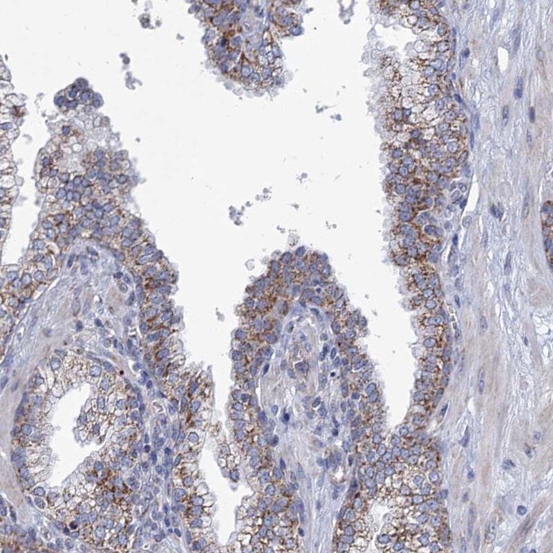 NDUFC2 Antibody - BSA Free Immunohistochemistry-Paraffin: NDUFC2 Antibody [NBP1-88934]