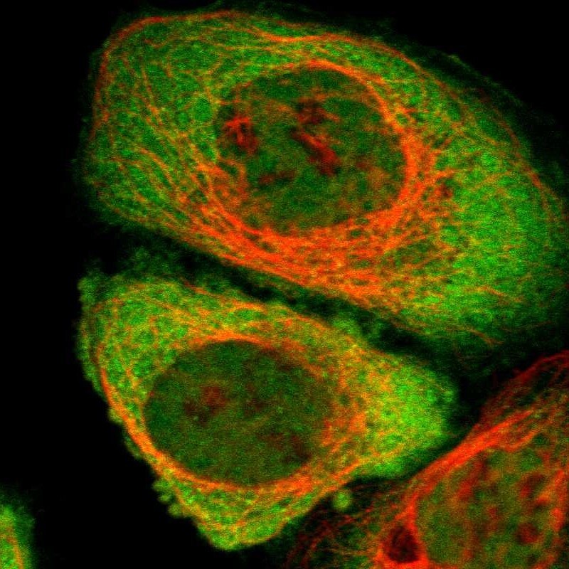CYTIP Antibody - BSA Free Immunocytochemistry/ Immunofluorescence: CYTIP Antibody [NBP1-88946]