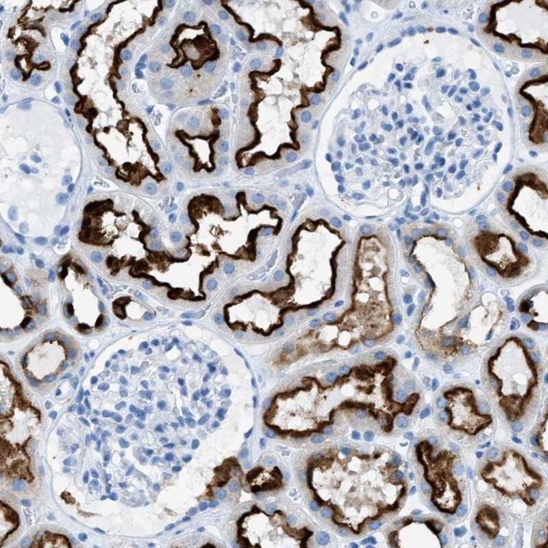 C21orf62 Antibody - BSA Free Immunohistochemistry: C21orf62 Antibody - BSA Free [NBP1-88947]
