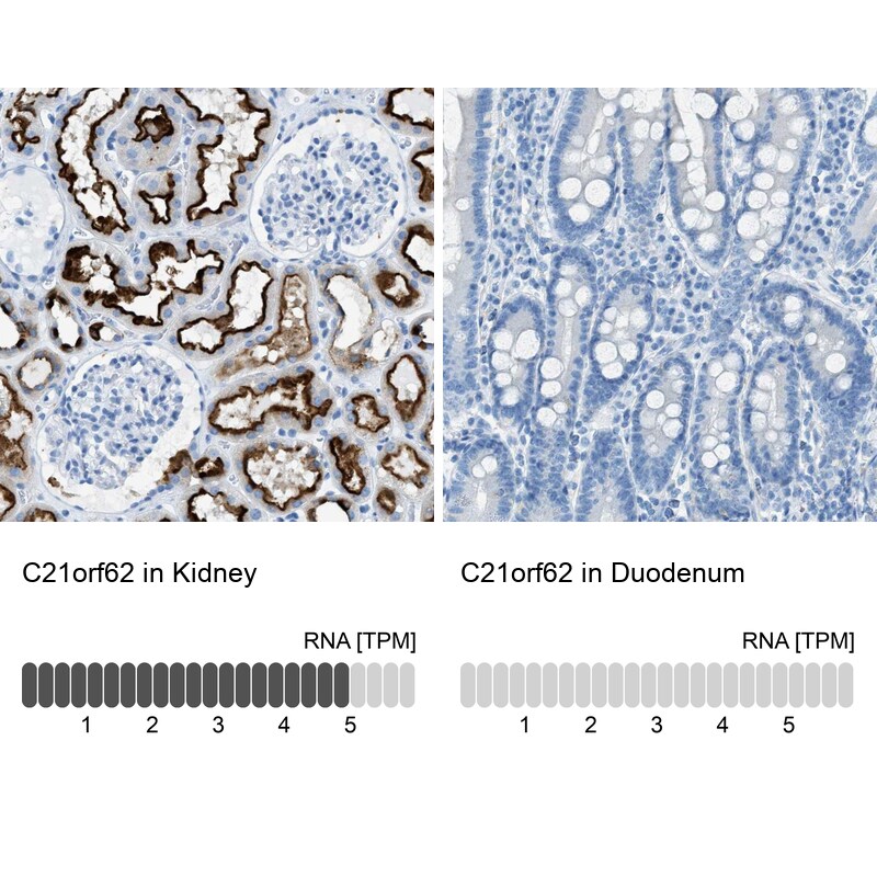 C21orf62 Antibody - BSA Free Immunohistochemistry: C21orf62 Antibody - BSA Free [NBP1-88947]