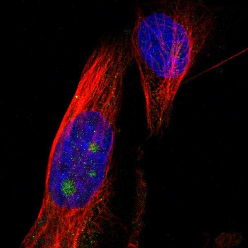 B3GNT5 Antibody - BSA Free Immunocytochemistry/ Immunofluorescence: B3GNT5 Antibody [NBP1-88954]