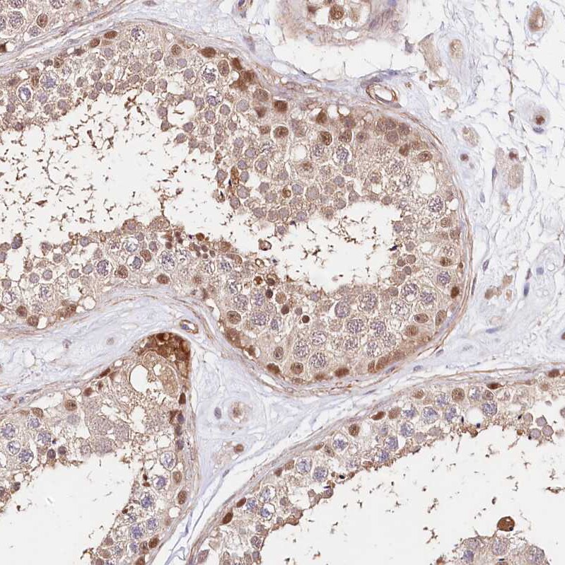 PPP2R5B Antibody - BSA Free Immunohistochemistry-Paraffin: PPP2R5B Antibody [NBP1-88958]