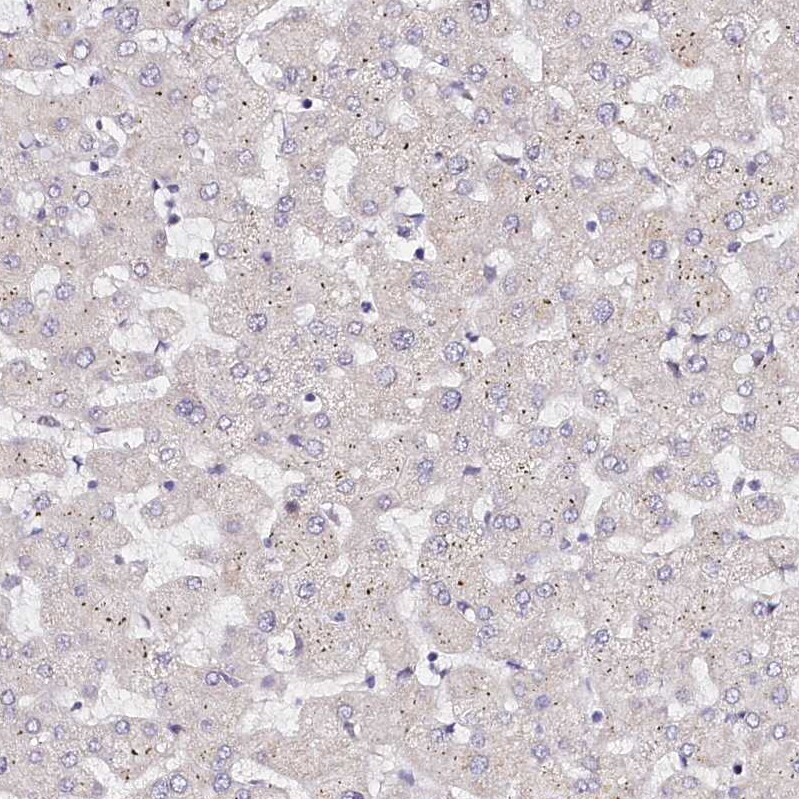 PPP2R5B Antibody - BSA Free Immunohistochemistry-Paraffin: PPP2R5B Antibody [NBP1-88958]