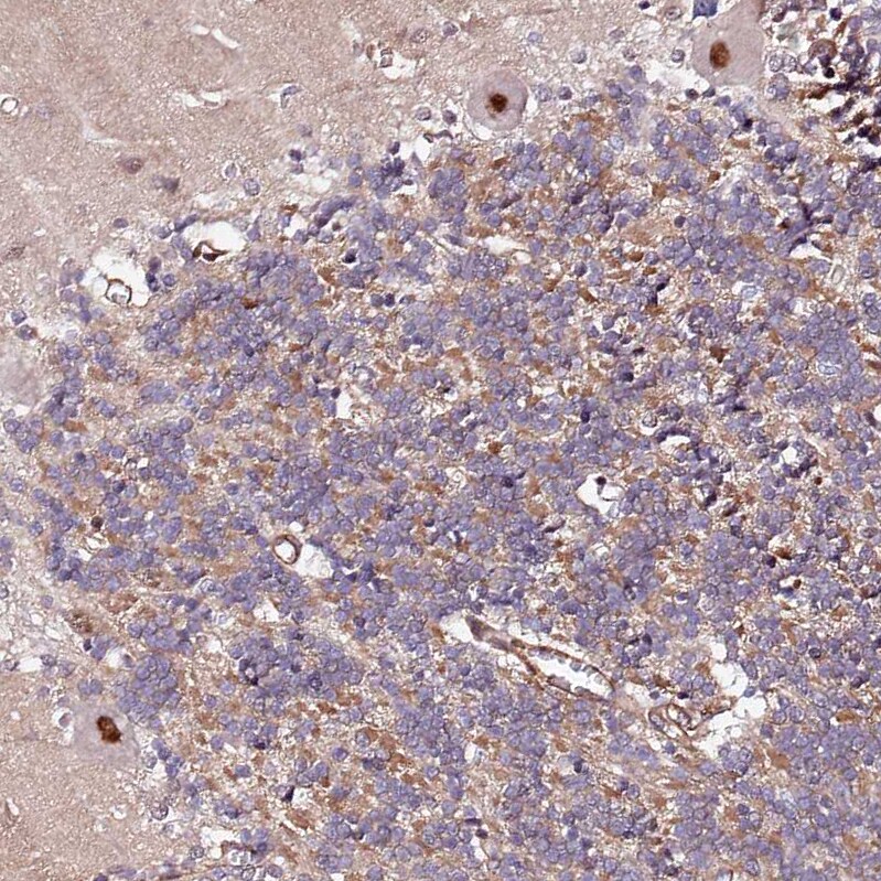 PPP2R5B Antibody - BSA Free Immunohistochemistry-Paraffin: PPP2R5B Antibody [NBP1-88958]