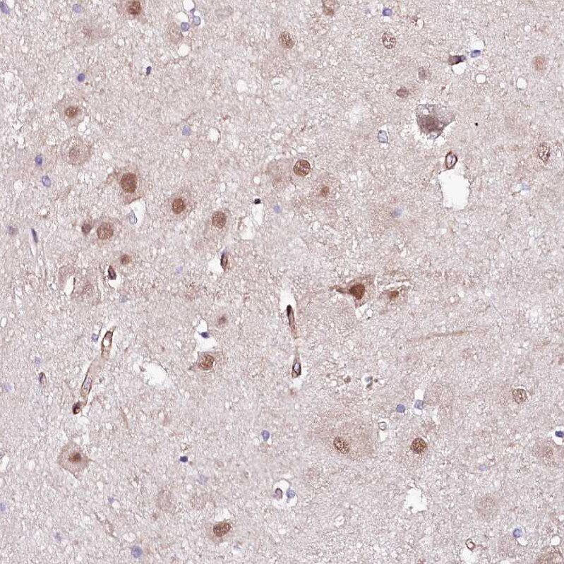 PPP2R5B Antibody - BSA Free Immunohistochemistry-Paraffin: PPP2R5B Antibody [NBP1-88958]