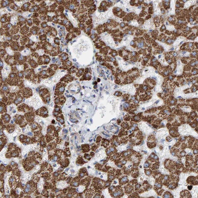 B9D1 Antibody - BSA Free Immunohistochemistry: B9D1 Antibody - BSA Free [NBP1-88969]