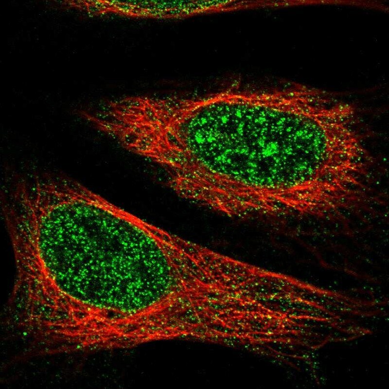 TET1 Antibody - BSA Free Immunocytochemistry/ Immunofluorescence: TET1 Antibody [NBP1-88972]