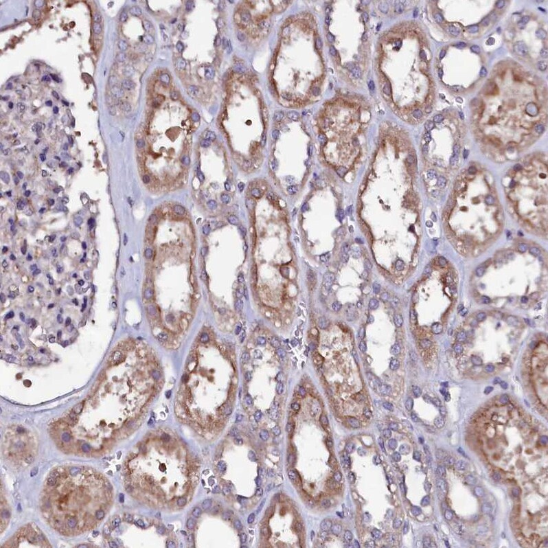 USPL1 Antibody - BSA Free Immunohistochemistry: USPL1 Antibody - BSA Free [NBP1-88973]