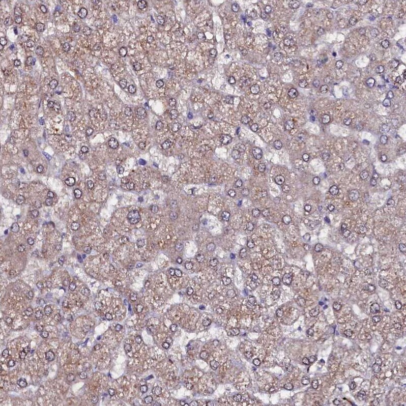 USPL1 Antibody - BSA Free Immunohistochemistry: USPL1 Antibody - BSA Free [NBP1-88973]