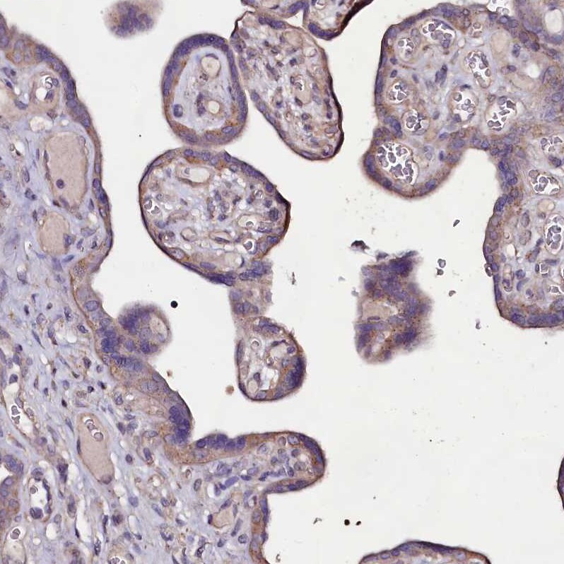 USPL1 Antibody - BSA Free Immunohistochemistry: USPL1 Antibody - BSA Free [NBP1-88973]