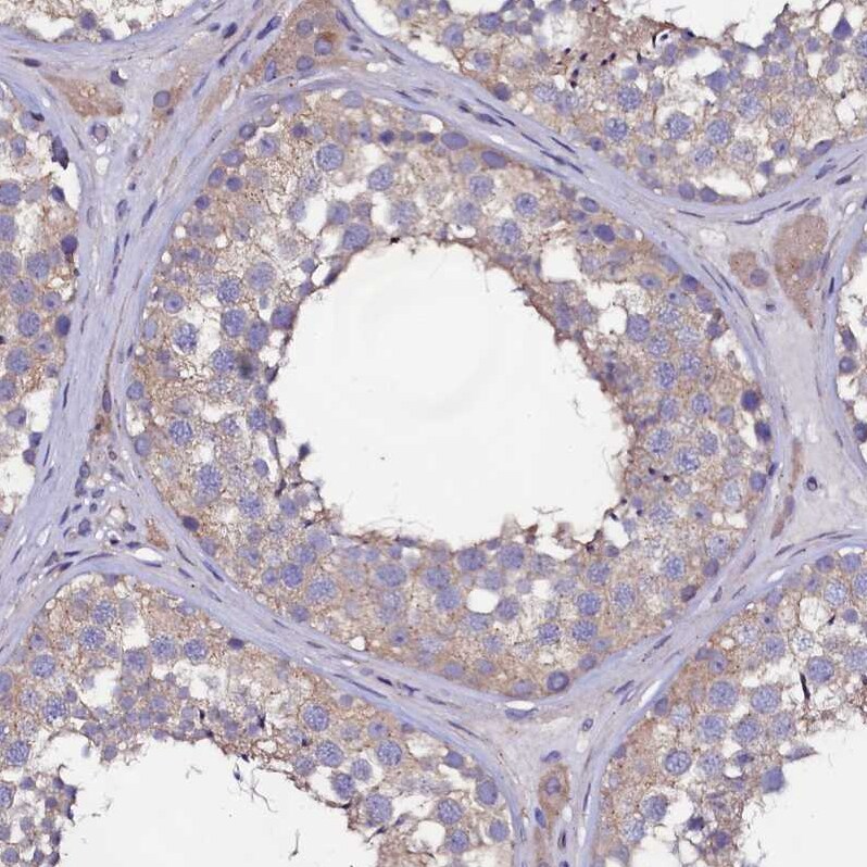 USPL1 Antibody - BSA Free Immunohistochemistry: USPL1 Antibody - BSA Free [NBP1-88973]