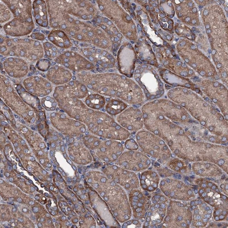 USPL1 Antibody - BSA Free Immunohistochemistry: USPL1 Antibody - BSA Free [NBP1-88974]