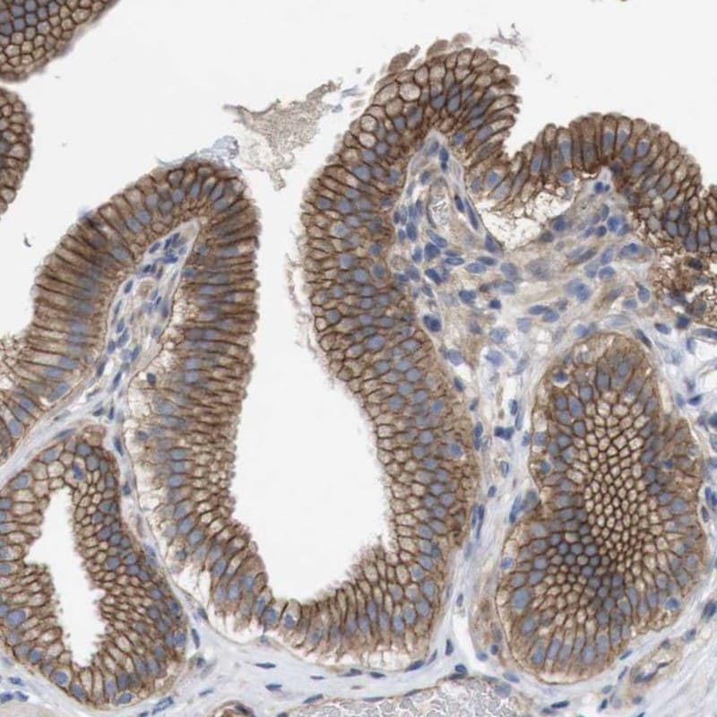 KIDINS220 Antibody - BSA Free Immunohistochemistry-Paraffin: KIDINS220 Antibody [NBP1-88995]