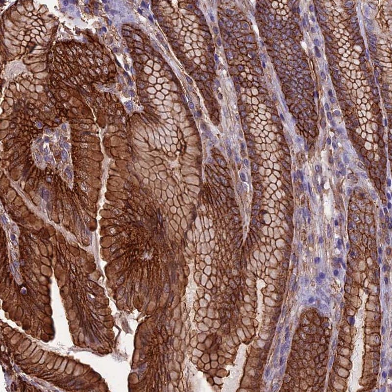 Angiopoietin-like Protein 2/ANGPTL2 Antibody - BSA Free Immunohistochemistry: Angiopoietin-like Protein 2/ANGPTL2 Antibody - BSA Free [NBP1-88997]